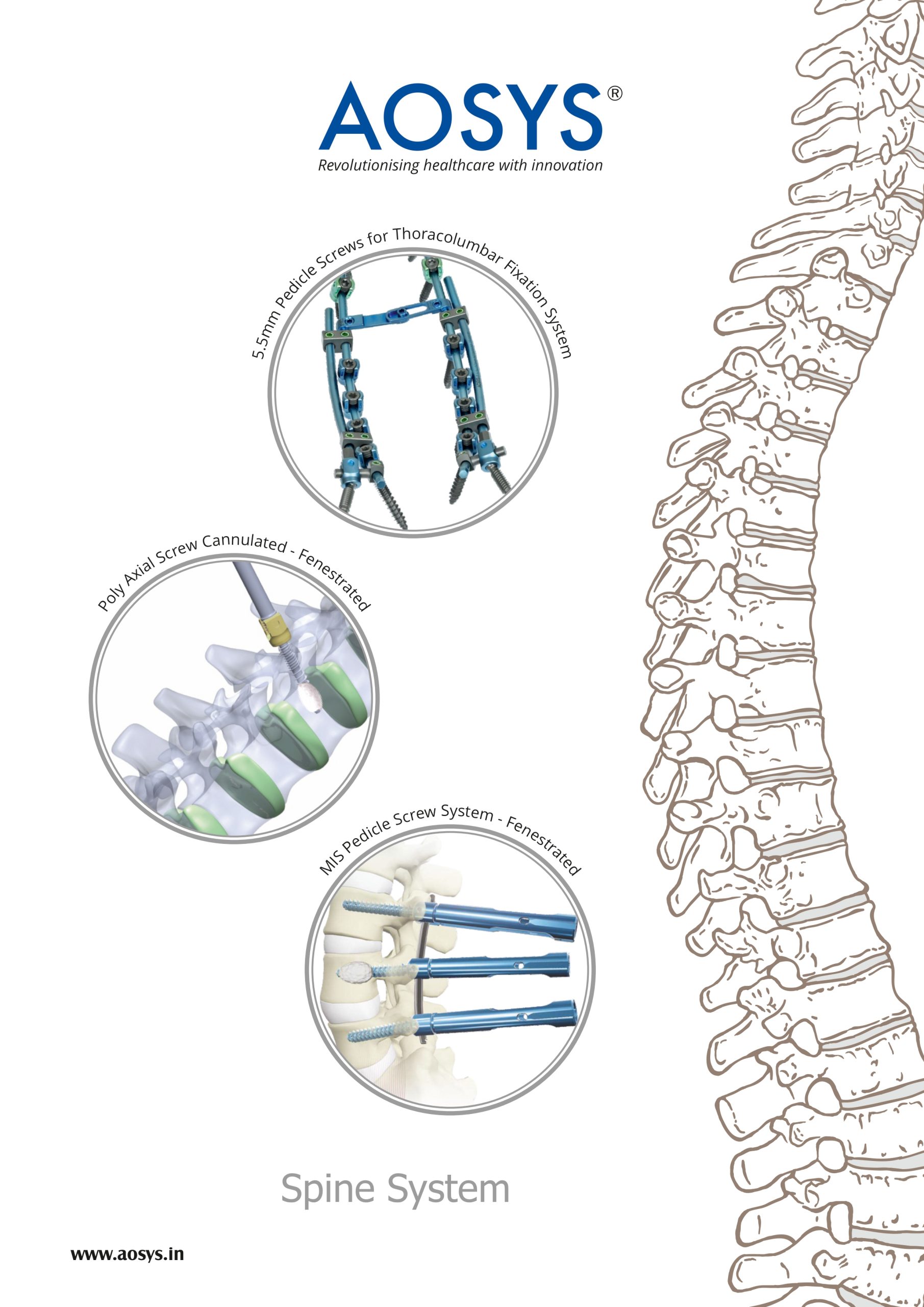 Aosys-Spine-System-