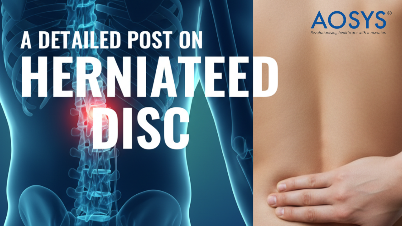 A DETAILED POST ON HERNIATED DISC