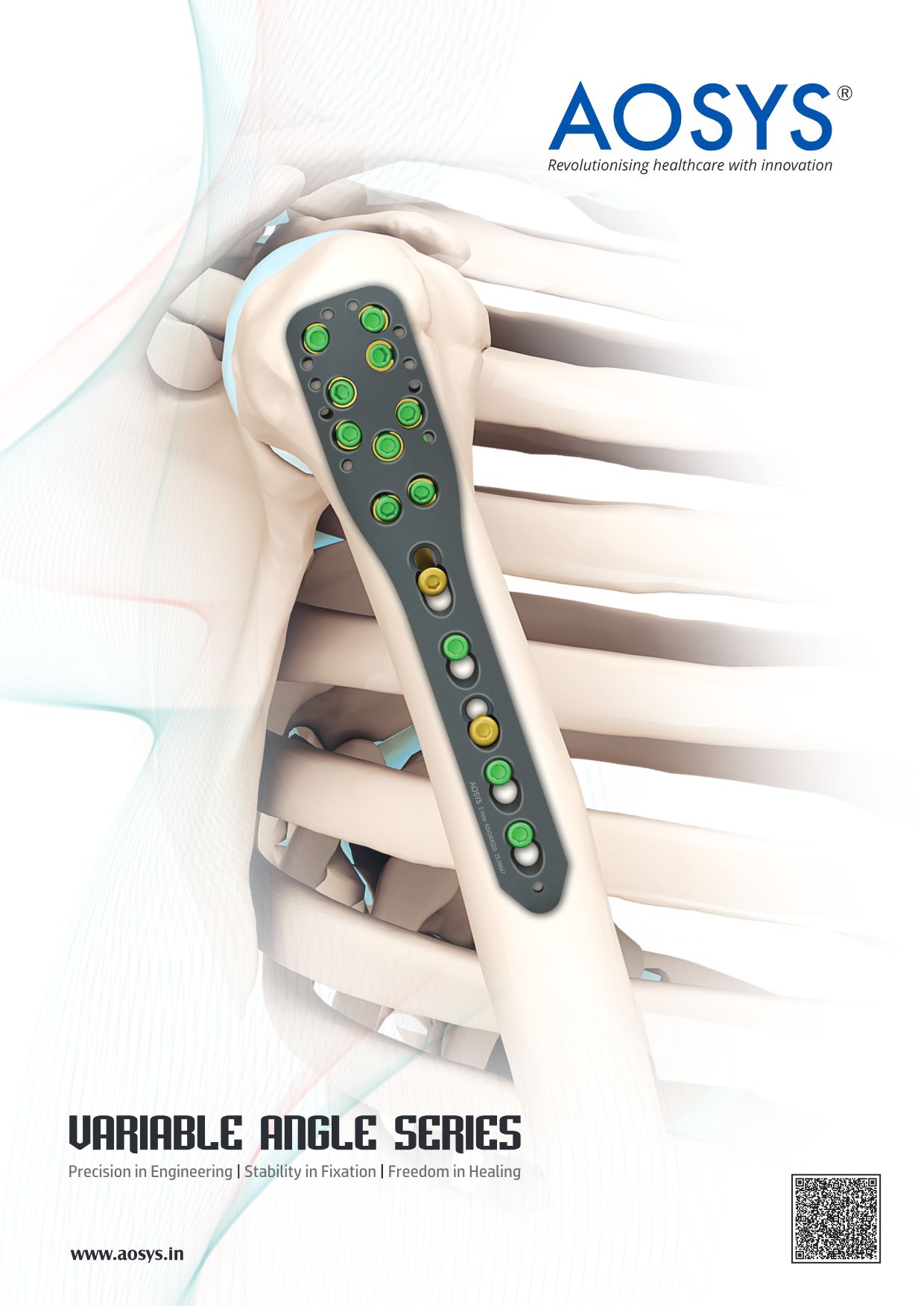 AOSYS Variable Angle Ring System