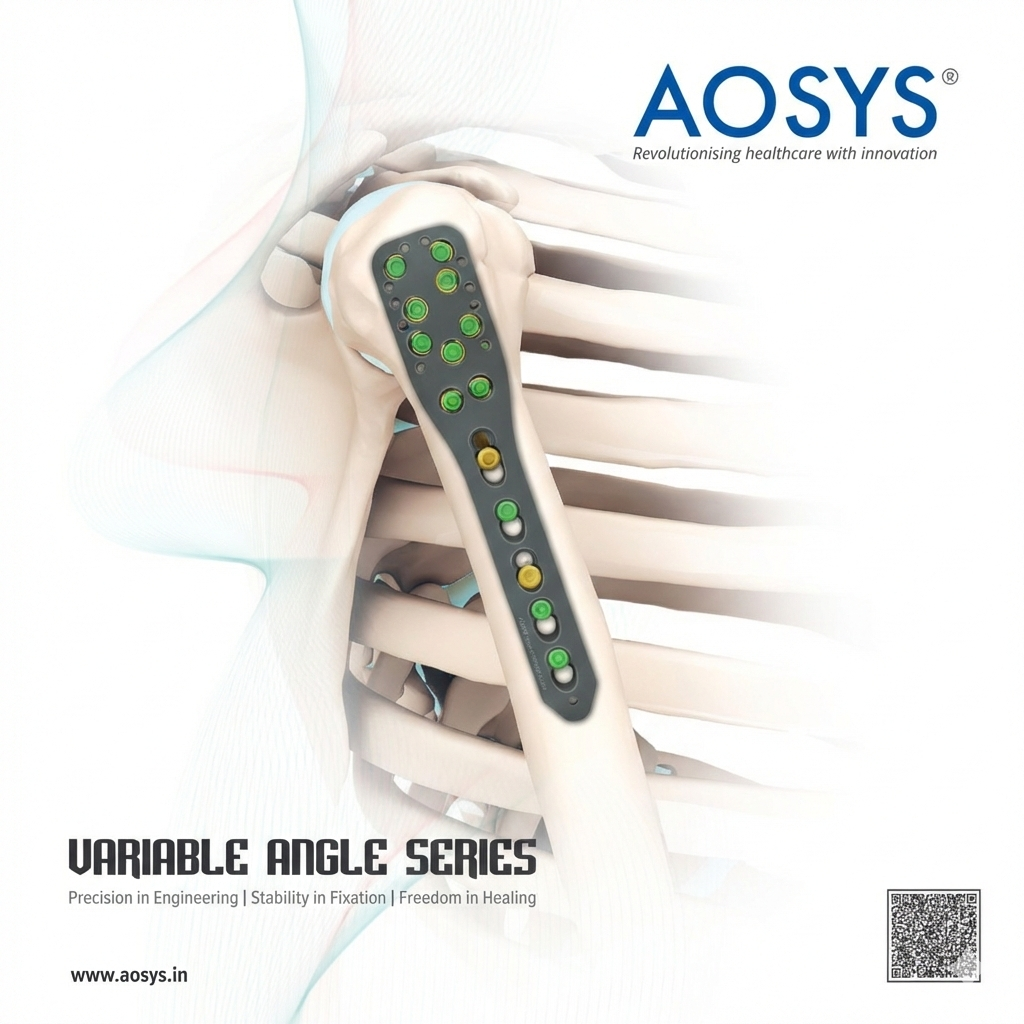 AOSYS Variable Angle Ring System