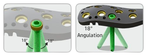 VA-Locking-Proximal-Humerus-Plate-Angulation | AOSYS PVT LTD