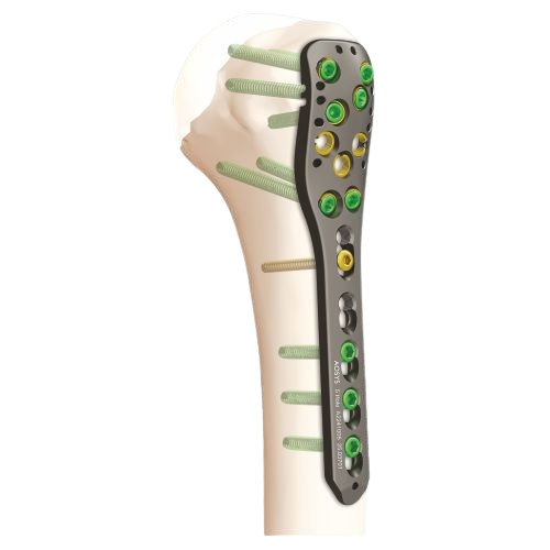 VA-Locking-Proximal-Humerus-Plate | AOSYS PVT LTD