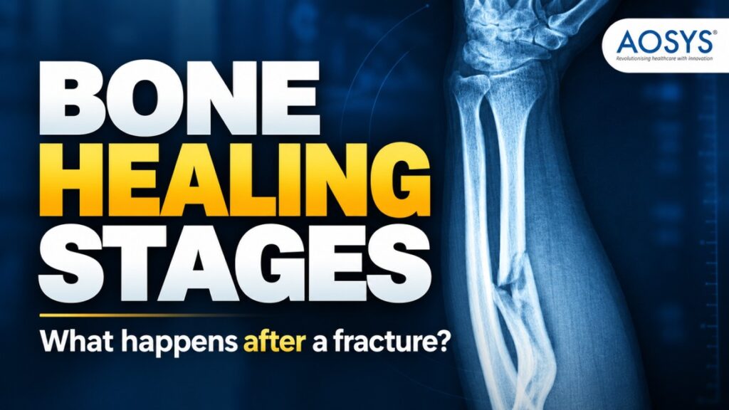 Bone Healing Stages: How Fractures Heal & What Affects Recovery